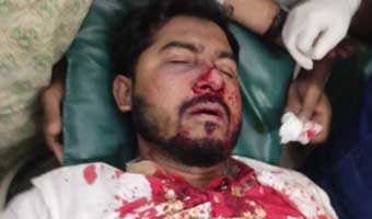 আইনশৃঙ্খলাবাহিনীর সঙ্গে সংঘর্ষে আহত নুরুল হক নুর