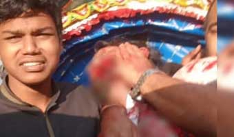 গুলিবিদ্ধ হাদি লাইফ সাপোর্ট গুলিবিদ্ধ হাদি লাইফ সাপোর্ট