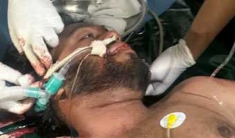 হাদির মাথা থেকে গুলি অপসারণে অস্ত্রোপচার চলছে হাদির মাথা থেকে গুলি অপসারণে অস্ত্রোপচার চলছে
