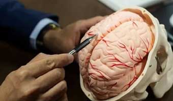 মানুষের নিউরন দিয়ে কৃত্রিম মস্তিষ্ক তৈরি করল ইরান