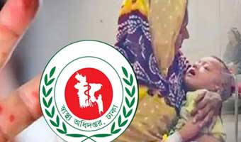 হাম উপসর্গে সিলেটে আরও ৪ শিশুর মৃত্যু