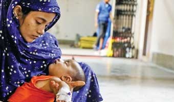 হাম উপসর্গে গত ২৪ ঘণ্টায় ৭ শিশু মারা গেছে